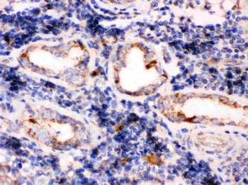 TPP1 Rabbit Polyclonal Antibody
