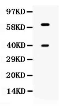 TPP1 Rabbit Polyclonal Antibody