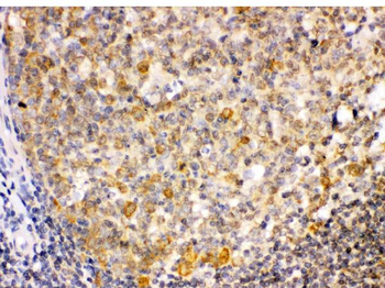 TRIB2 Rabbit Polyclonal Antibody