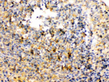 TRIB2 Rabbit Polyclonal Antibody
