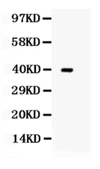 TRIB2 Rabbit Polyclonal Antibody