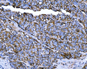 TRPM4 Rabbit Polyclonal Antibody
