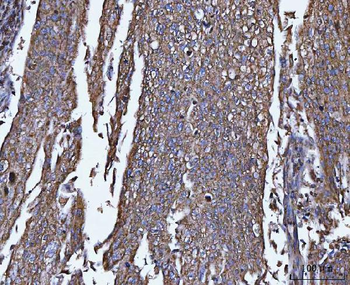 TRPM4 Rabbit Polyclonal Antibody