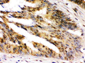 NIRF/UHRF2 Rabbit Polyclonal Antibody