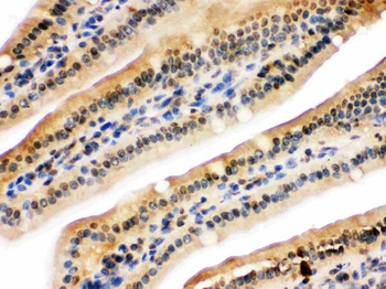 NIRF/UHRF2 Rabbit Polyclonal Antibody