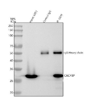 SIAH Interacting Protein/CACYBP Antibody