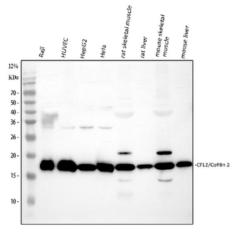 Cofilin 2/CFL2 Rabbit Polyclonal Antibody