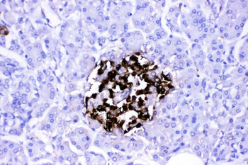 VIP peptides VIP Rabbit Polyclonal Antibody