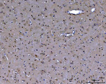 ABL2 Rabbit Polyclonal Antibody