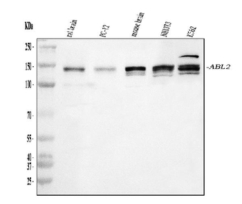 ABL2 Rabbit Polyclonal Antibody