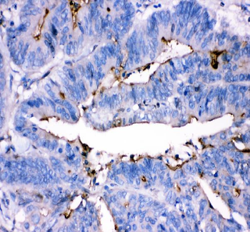 ADA Rabbit Polyclonal Antibody