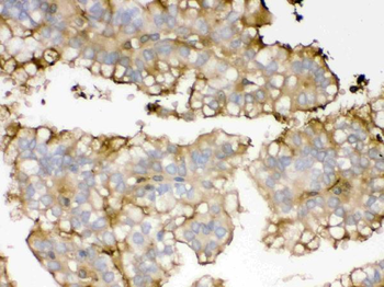 Apolipoprotein A I/APOA1 Rabbit Polyclonal Antibody