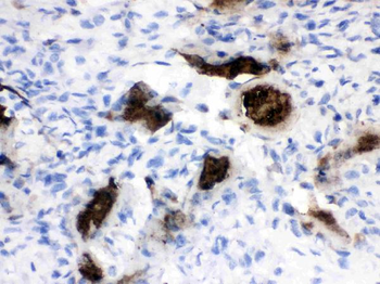 Osteocalcin/BGLAP Rabbit Polyclonal Antibody