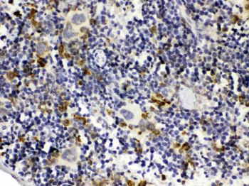 GC1q R/C1QBP Rabbit Polyclonal Antibody