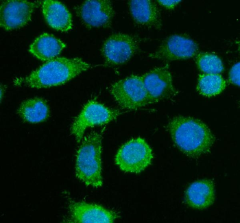 Caldesmon/CALD1 Antibody