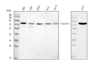 Caldesmon/CALD1 Antibody
