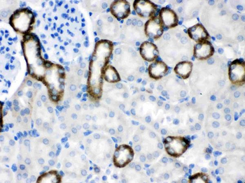 Calcium Sensing Receptor/CASR Rabbit Polyclonal Antibody