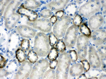 Calcium Sensing Receptor/CASR Rabbit Polyclonal Antibody