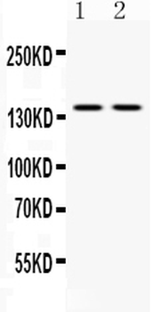 Calcium Sensing Receptor/CASR Rabbit Polyclonal Antibody