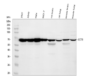 CCT3 Rabbit Polyclonal Antibody