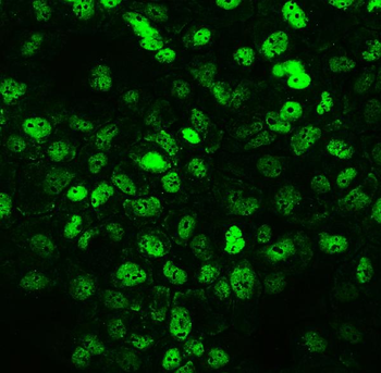 CCT3 Rabbit Polyclonal Antibody