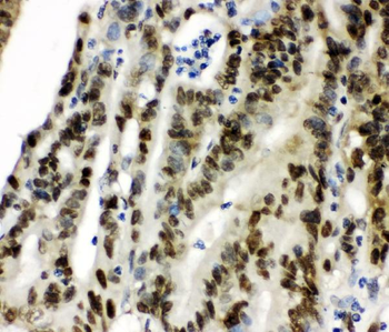 CCT3 Rabbit Polyclonal Antibody