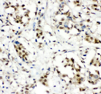 CCT3 Rabbit Polyclonal Antibody