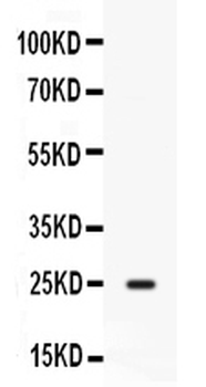 CD9 Rabbit Polyclonal Antibody
