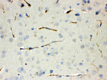 Calcitonin/CALCA Rabbit Polyclonal Antibody