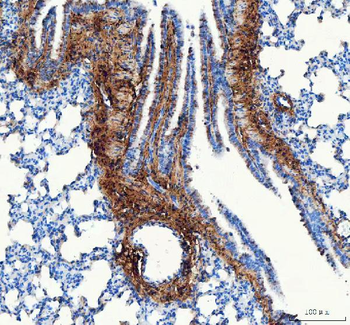 Collagen I/COL1A1 Antibody