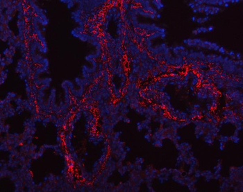 Collagen I/COL1A1 Antibody