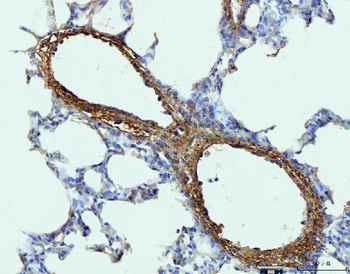 Collagen I/COL1A1 Antibody