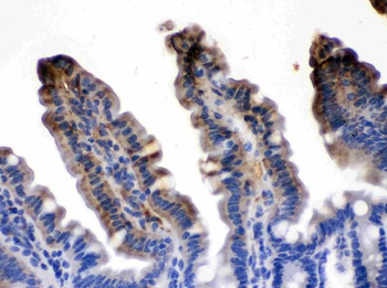 Intestinal FABP/FABP2 Rabbit Polyclonal Antibody