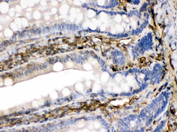 FGF1 Rabbit Polyclonal Antibody