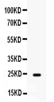 FGF1 Rabbit Polyclonal Antibody