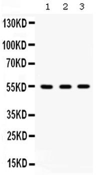 Integrin linked ILK Rabbit Polyclonal Antibody