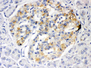 ISG15 Rabbit Polyclonal Antibody