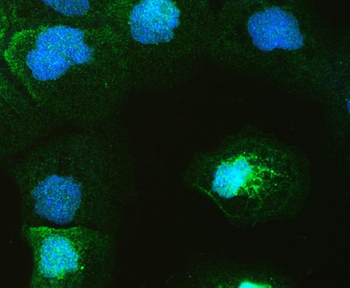 GAL4/LGALS4 Rabbit Polyclonal Antibody