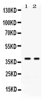 GAL4/LGALS4 Rabbit Polyclonal Antibody