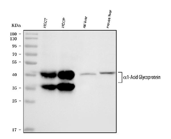 Alpha 1 Acid Glycoprotein/ORM1 Rabbit Polyclonal Antibody