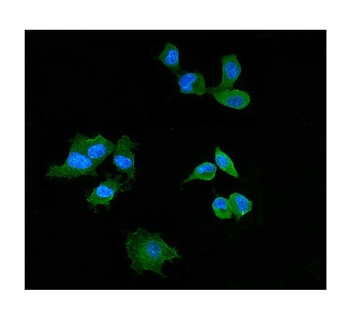 Elafin/Skalp/PI3 Rabbit Polyclonal Antibody