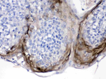 Elafin/Skalp/PI3 Rabbit Polyclonal Antibody