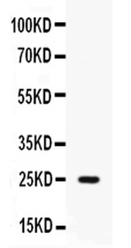 Elafin/Skalp/PI3 Rabbit Polyclonal Antibody