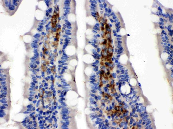 Glucose Transporter 5 GLUT5/SLC2A5 Rabbit Polyclonal Antibody