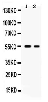 Glucose Transporter 5 GLUT5/SLC2A5 Rabbit Polyclonal Antibody