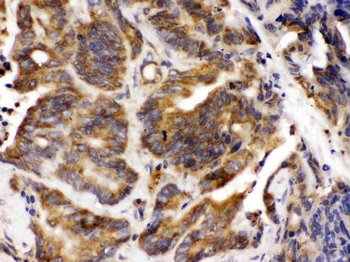 Talin 2/TLN2 Rabbit Polyclonal Antibody