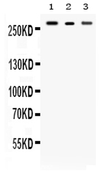 Talin 2/TLN2 Rabbit Polyclonal Antibody