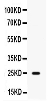 HE4/WFDC2 Rabbit Polyclonal Antibody