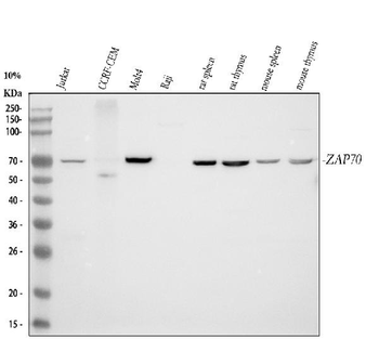 ZAP70 Rabbit Polyclonal Antibody