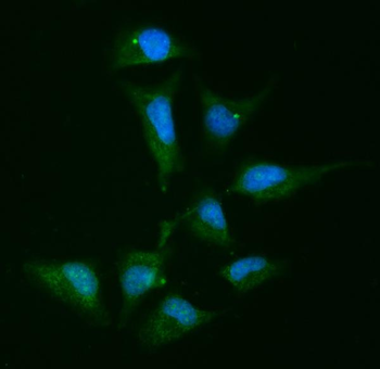 Alpha Actinin 4/ACTN4 Antibody